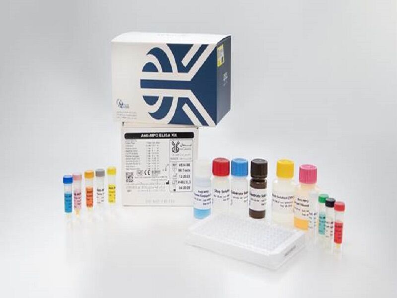 تولید ۷ کیت تشخیصی با صرفهجویی ارزی ۱۷ میلیون دلاری