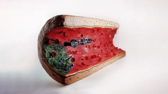 میکروذرات خودران وارد حوزه دارورسانی میشوند