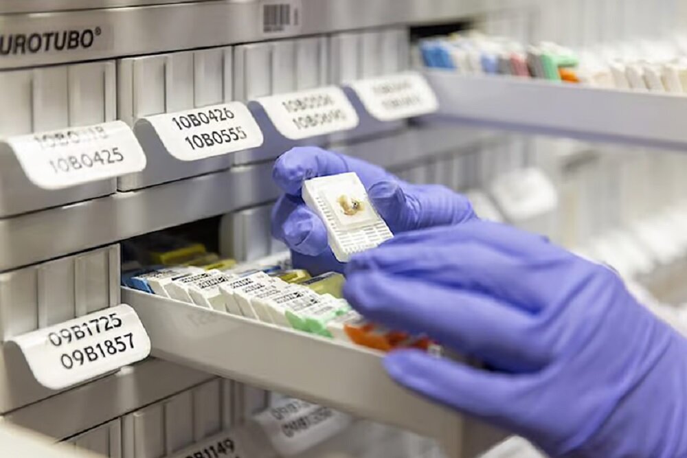 بهرهبرداری از بیوبانک بافت مغز تا ۱۴۰۷/افق روشن درمان پارکینسون با سلولهای بنیادی