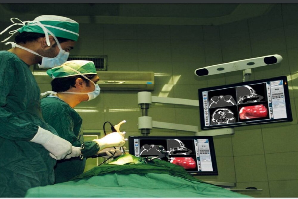 ثبت ۱۲هزار جراحی با سامانه نویگیشن ایرانی/سهم ۸۳ درصدی جراحیهای مغز و اعصاب با سیستم بومی